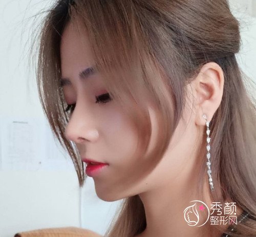 济南韩氏整形美容医院价格明细表一览+附隆鼻案例分享。