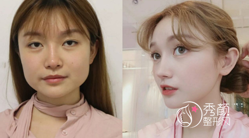 国内具有磨骨资质的医生都有哪些？