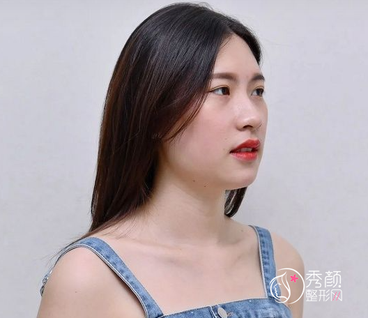 南京医科大吴国平正颌手术怎么样|个人资料|口碑|附正颌案例反馈。