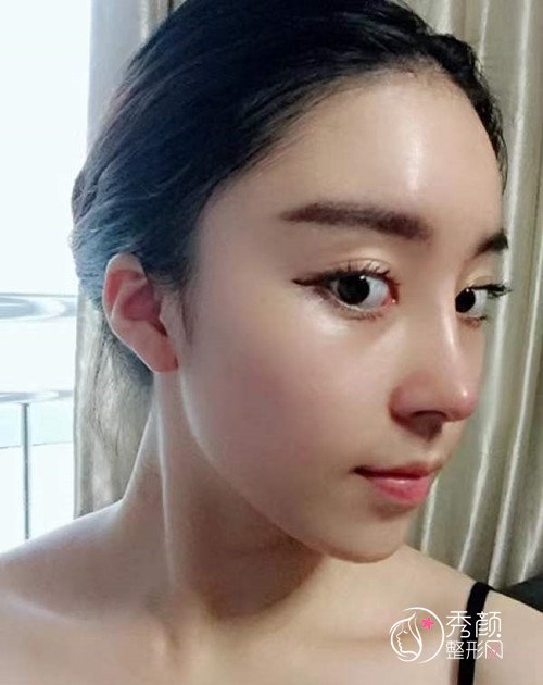 重庆五洲整形范文亮隆鼻怎么样|个人资料|口碑|附鼻部手术案例