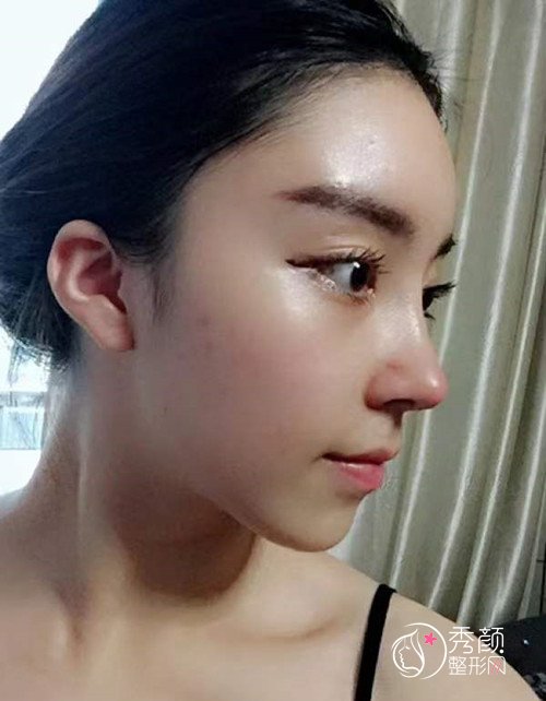 重庆五洲整形范文亮隆鼻怎么样|个人资料|口碑|附鼻部手术案例