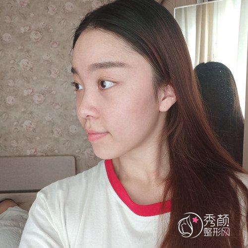 重庆五洲整形范文亮隆鼻怎么样|个人资料|口碑|附鼻部手术案例