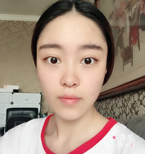 重庆五洲整形范文亮隆鼻怎么样|个人资料|口碑|附鼻部手术案例