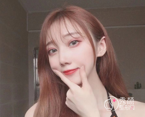 沈阳杏林史灵芝双眼皮技术怎么样|附割双眼皮案例反馈
