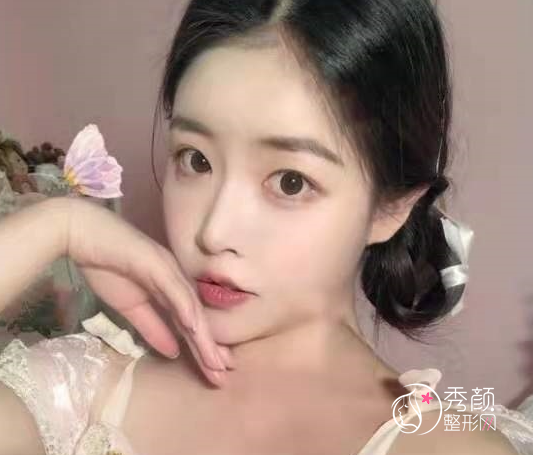 青岛伊美尔还是华韩好？附整形专家团队+隆鼻案例反馈分享