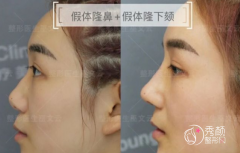 北京隆鼻面诊了刘彦军、王英勇、巫文云、李劲良等。