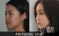 上海九院正颌手术哪个医生好,医生口碑技术大对比。