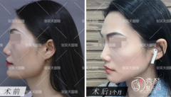 北京磨骨张笑天和邱立东哪个更好|技术审美口碑对比