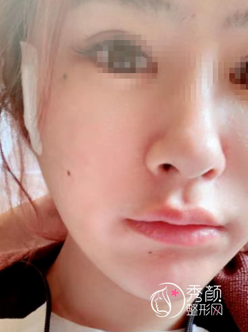四川友谊罗恩磨骨怎么样,都说他保守自然是真的吗？罗恩个人资料