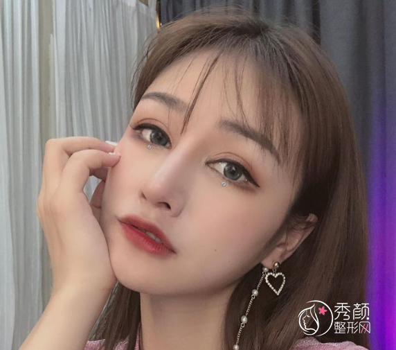 杭州李保锴做鼻子怎么样，花了68000元找李保锴做了初鼻！