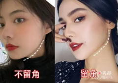 <b>上海磨骨有什么风险和后遗症？需要注意什么？</b>