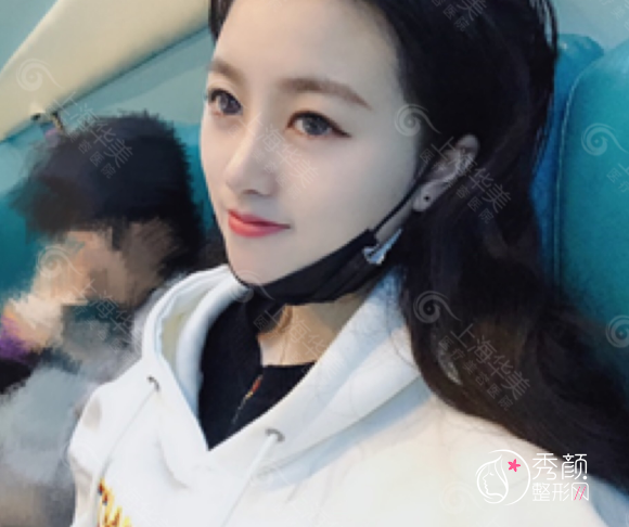上海华美叶丽萍做鼻子怎么样，有没有失败案例？附叶丽萍隆鼻修复案例分享