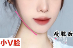 上海首尔丽格石润、华美李志海和美联臣曹栋弼哪个磨骨技术好？