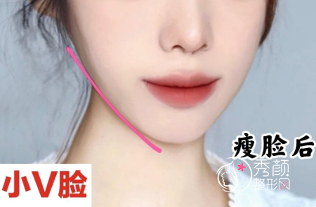 上海首尔丽格石润、华美李志海和美联臣曹栋弼哪个磨骨技术好？