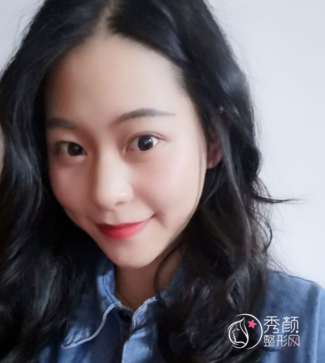 姜民范磨骨怎么样，不知不觉找姜民范磨骨手术已经三个月了