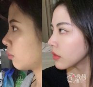 国内有哪些做正颌手术好的医生？ 国内十大正颌医生