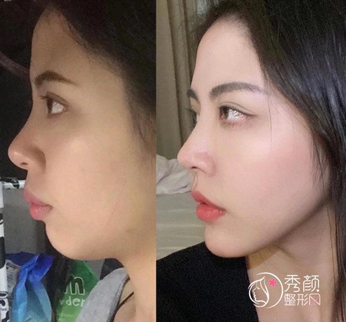 国内有哪些做正颌手术好的医生？ 国内十大正颌医生