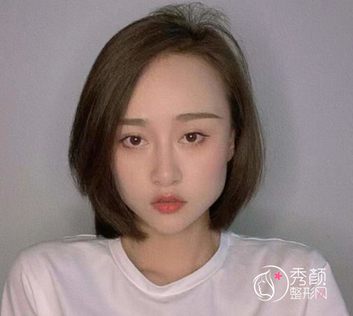 杭州整形医院唐冬生磨骨怎么样，有没有失败案例？