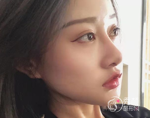杭州整形医院唐冬生磨骨怎么样，有没有失败案例？