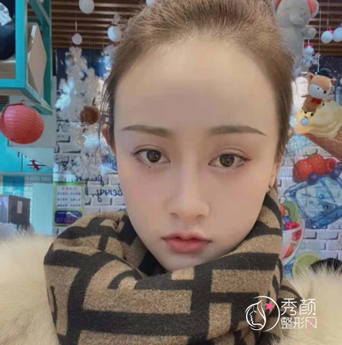 杭州整形医院唐冬生磨骨怎么样，有没有失败案例？