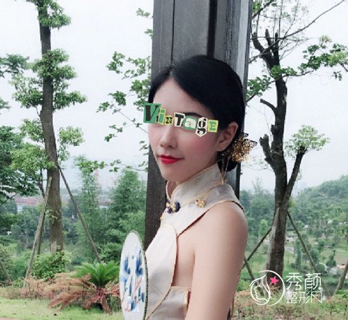 重庆美仑美奂杜亚旭隆鼻手术做得怎么样，附杜亚旭隆鼻案例参考