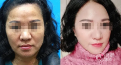 <b>北京加减美穆宝安v美减龄手术真的靠谱吗？</b>