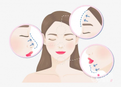 绵阳涪城医而美医学美容整形医院整形价格表一览【2022】