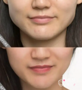 国内十大磨骨专家是谁？张笑天|何照华|朴兴植|张立天|罗恩哪个好?