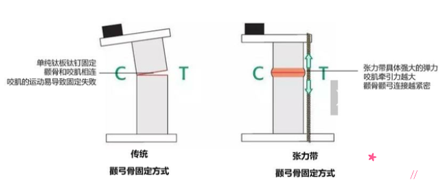 北京何照华磨骨口碑怎么样，有没有失败案例？