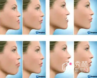 上海九院正颌手术哪个医生好？上海九院十大正颌医生