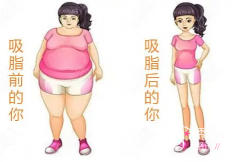 上海十大吸脂医院医生测评：曹卫刚、顾清、殷初阳、何斌、荣铮等。