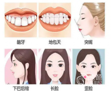 国内做正颌手术哪些医生比较好？朴兴植|吴中兴|李自力|沈国芳等。