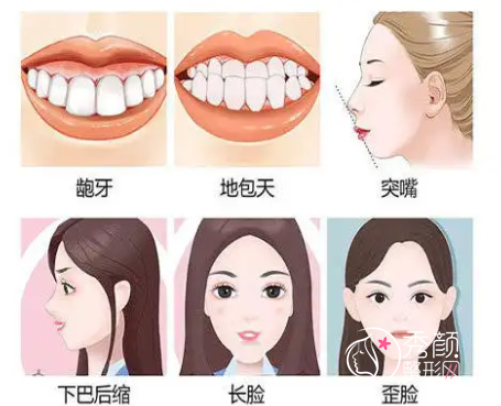 国内做正颌手术哪些医生比较好？朴兴植|吴中兴|李自力|沈国芳等。