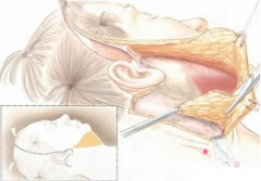 上海九院拉皮手术医生哪个好，丁伟|金云波|张余光口碑技术对比