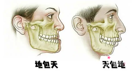 上海九院地包天手术哪个医生好，大概需要多少钱？
