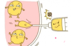 深圳哪家医院抽脂技术好，深圳美莱|人民医院|第三人民医院上榜