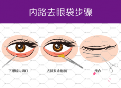 北京八大处祛眼袋多少钱，哪个医生好？