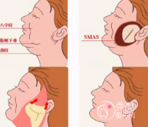 昆明拉皮手术哪里好，吴氏嘉美vs美伊莱vs铜雀台
