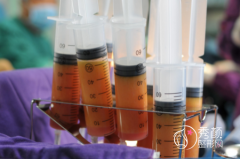 潍坊抽脂医院哪个好，人民医院、坤娜整形、天宏整形等口碑都不错