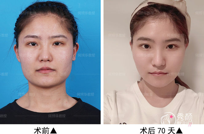 北京磨骨医生排行榜前三公布，张笑天、彭喆、何照华上榜！