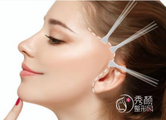 上海九院哪位医生拉皮手术好？顾斌、金云波、林晓曦、张余光、丁伟、等。