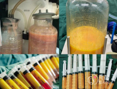 三甲医院吸脂手术多少钱？附2023吸脂价格表一览