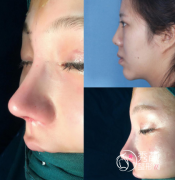 重庆隆鼻排名前十的医生盘点：王旭明、单磊、毕胜、范文亮等上榜！