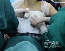 北京隆胸哪家医院好？八大处、联合丽格、北医三院、东方和谐、画美等医院上