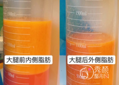 上海吸脂好的医院推荐：上海华美、薇琳、艺星、伯思立、伊莱美等这几家医院