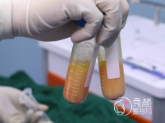 温州哪个医院吸脂效果好？温州艺星、伯思立、星范等这五家医院口碑不错