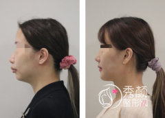 国内做正颌手术哪家医院好？上海九院、广大医院、首尔丽格、北大口腔医院上