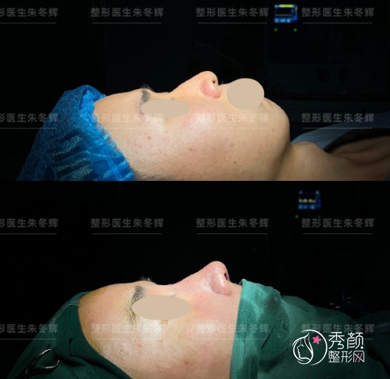 上海星时代朱冬辉隆鼻怎么样，有没有失败案例？