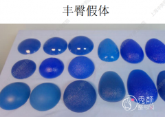 上海华美假体丰臀怎么样，来看谢卫国院长的假体丰臀案例就知道有多好了！