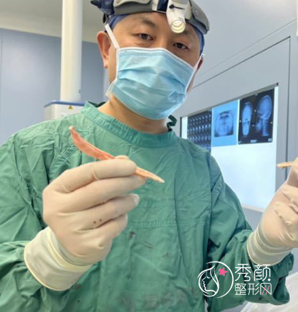 西安改脸型医生籍建华下颌角磨骨怎么样，有没有失败案例？